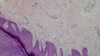 Hücresel yapıyı ve boyama kalıplarını gösteren doku örneklerinin mikroskobik görünümü