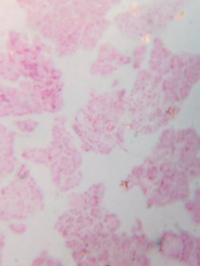 Mikroskop altında İnsan Pankreas Acini Tarihi