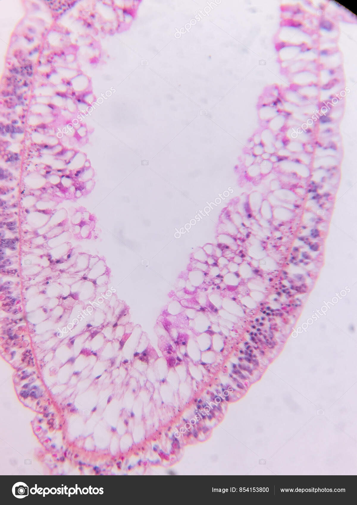 New Class of Crosslinker-Free Nanofiber Biomaterials from Hydra Nematocyst  Proteins | Scientific Reports, image size:1200x1700