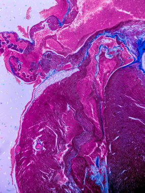 kardiyak kas dokusu ve endokardiyum fotoğrafı