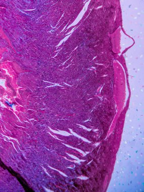 kardiyak kas dokusu ve endokardiyum fotoğrafı