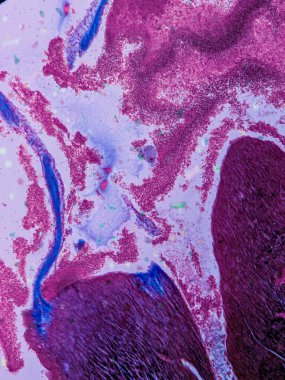 kardiyak kas dokusu ve endokardiyum fotoğrafı