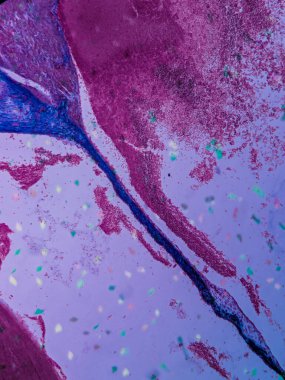 photo of Cardiac Muscle Tissue and Endocardium