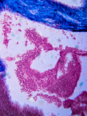 kardiyak kas dokusu ve endokardiyum fotoğrafı