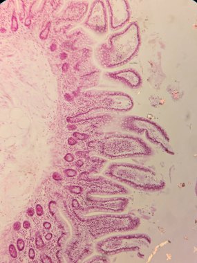 Villi ve Crypts 'li İnsan Jejunum