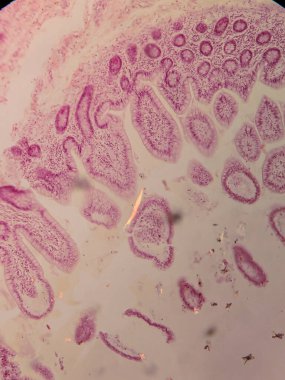 Villi ve Crypts 'li İnsan Jejunum