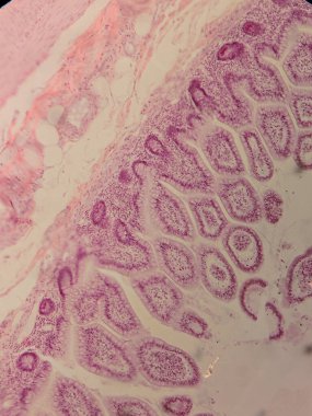 Villi ve Crypts 'li İnsan Jejunum