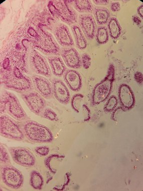 Villi ve Crypts 'li İnsan Jejunum