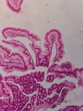 Villi ve Crypts 'li İnsan Jejunum