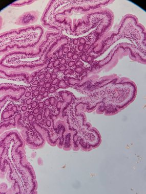 Villi ve Crypts 'li İnsan Jejunum