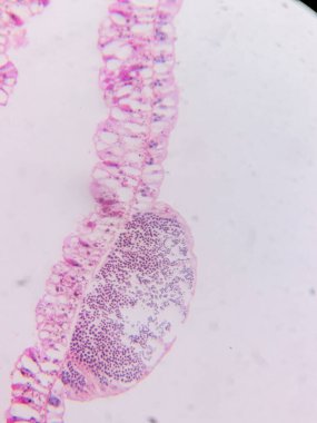 Hidra 'nın Testisleri mikroskop altında