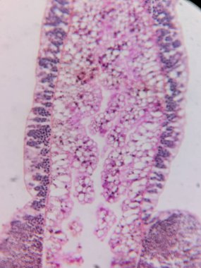 Hidra 'nın Testisleri mikroskop altında