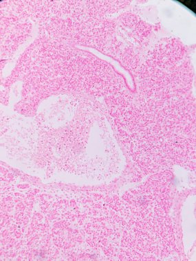 Kurbağa Pankreası: Exocrine ve Endokrin Dokuları