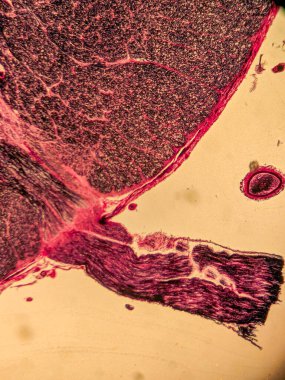 Mikroskop altında İnsan Omurgası, Weigert Lekesi