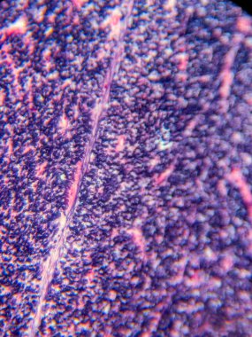 Mikroskop altında İnsan Omurgası, Weigert Lekesi