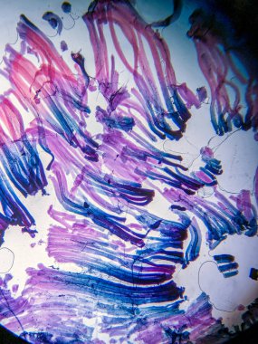 Motor Sinir Sonu Kas Dokusunda