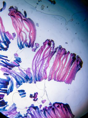 Motor Sinir Sonu Kas Dokusunda