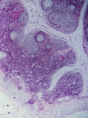 Mikroskop altında Domuz Lenf Düğümü Tarihi