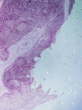 Mikroskop altında Domuz Lenf Düğümü Tarihi