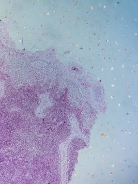 Mikroskop altında Domuz Lenf Düğümü Tarihi