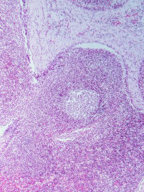 Mikroskop altında Domuz Lenf Düğümü Tarihi