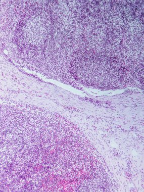 Mikroskop altında Domuz Lenf Düğümü Tarihi