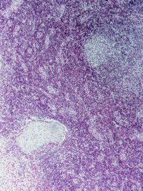 Mikroskop altında Domuz Lenf Düğümü Tarihi