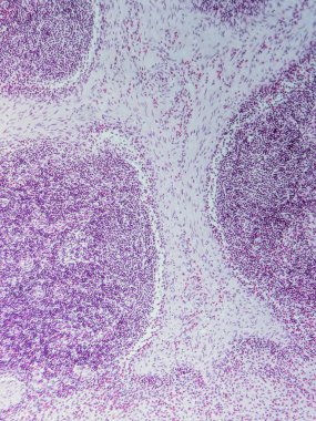 Mikroskop altında Domuz Lenf Düğümü Tarihi