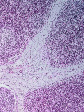 Mikroskop altında Domuz Lenf Düğümü Tarihi