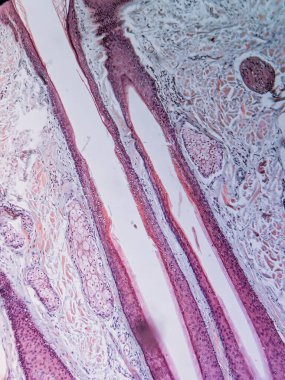 İnsan Kafaderisinde Saç kökleri ve Sebaceous bezleri