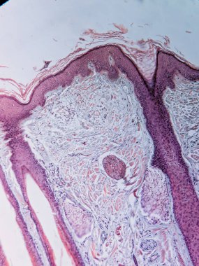 İnsan Kafaderisinde Saç kökleri ve Sebaceous bezleri