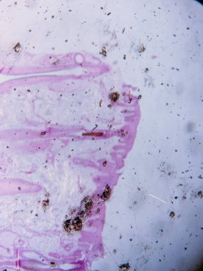 Mikroskop altında İnsan Kafa Derisi Dokusunun Tariholojisi