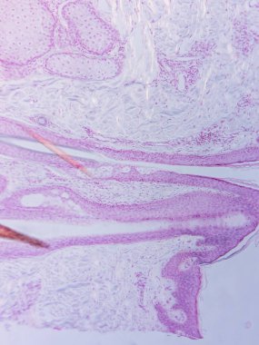 Mikroskop altında İnsan Kafa Derisi Dokusunun Tariholojisi