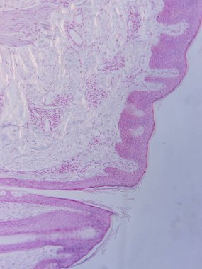 Mikroskop altında İnsan Kafa Derisi Dokusunun Tariholojisi