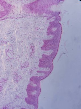 Mikroskop altında İnsan Kafa Derisi Dokusunun Tariholojisi