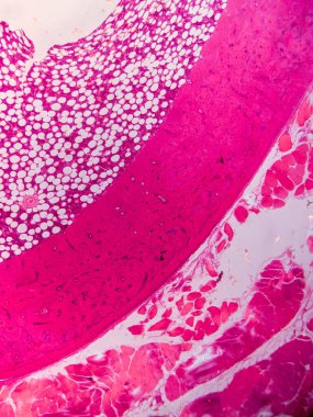 Dokuları Bağlayıcı ve Kas Katmanlarıyla Adialize Et