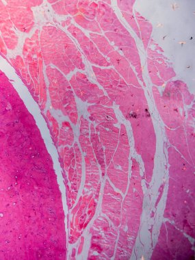 Dokuları Bağlayıcı ve Kas Katmanlarıyla Adialize Et