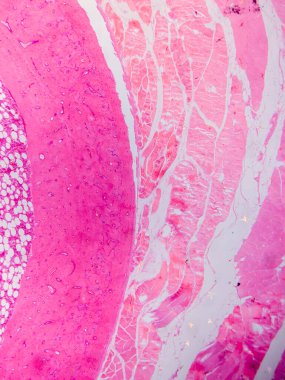 Dokuları Bağlayıcı ve Kas Katmanlarıyla Adialize Et