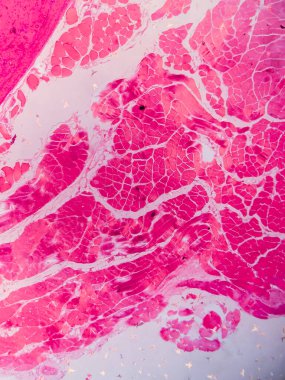 Dokuları Bağlayıcı ve Kas Katmanlarıyla Adialize Et