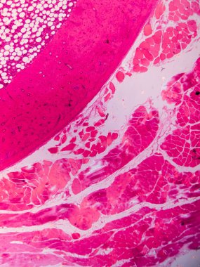 Dokuları Bağlayıcı ve Kas Katmanlarıyla Adialize Et