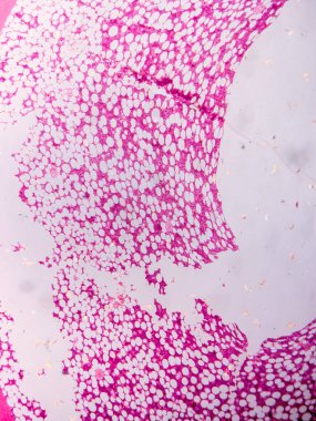 Dokuları Bağlayıcı ve Kas Katmanlarıyla Adialize Et