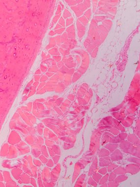 Dokuları Bağlayıcı ve Kas Katmanlarıyla Adialize Et