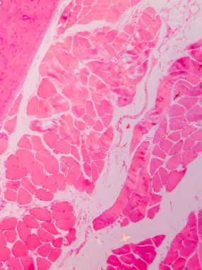 Dokuları Bağlayıcı ve Kas Katmanlarıyla Adialize Et