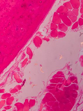 Dokuları Bağlayıcı ve Kas Katmanlarıyla Adialize Et