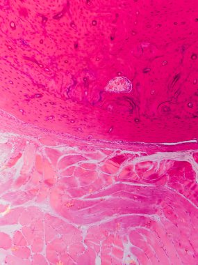 Dokuları Bağlayıcı ve Kas Katmanlarıyla Adialize Et