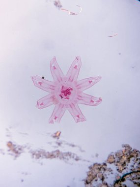 Aurelia Ephyra Sahnesinin Mikroskobik Görünümü