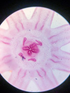 Aurelia Ephyra Sahnesinin Mikroskobik Görünümü