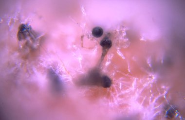 Fungal colonization of a food substrate, showing the growth of common black bread mold