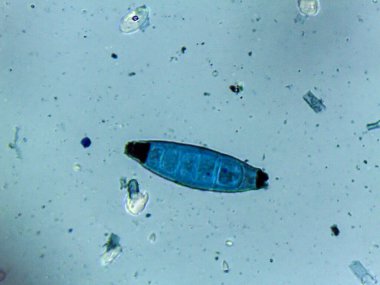 Lactophenol mavisi bir kalıbın çoklu septik üreme sporlarını vurgular..