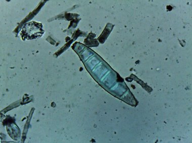 Lactophenol mavisi bir kalıbın çoklu septik üreme sporlarını vurgular..